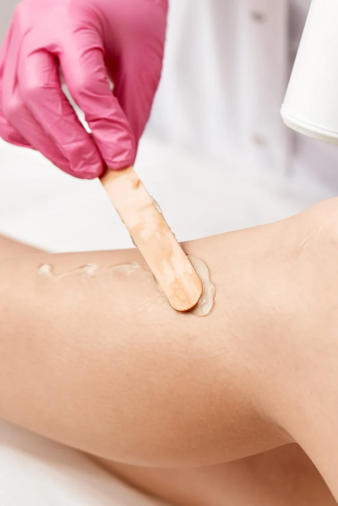 depilación en almería